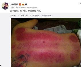 吃瓜后背纹身,揭秘吃瓜群众的神秘符号